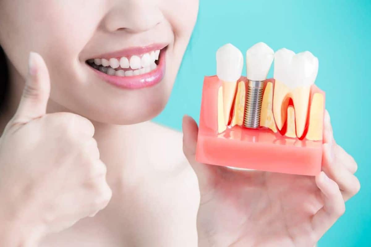 what can dental implants do for you