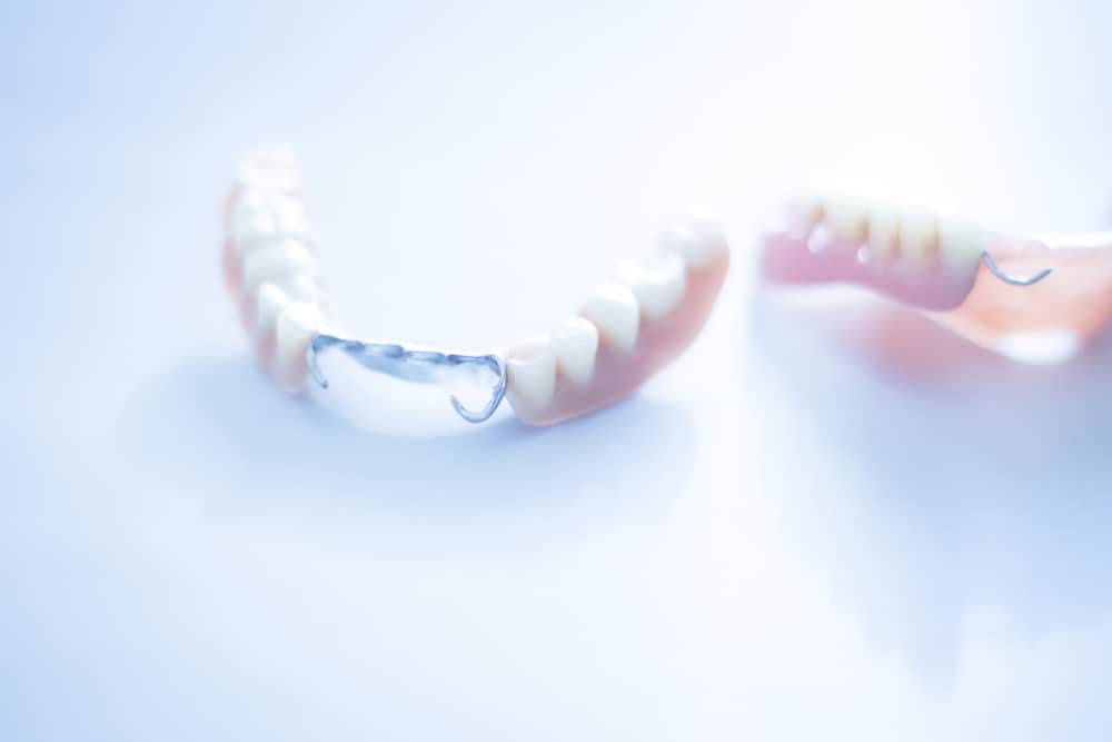 are removable partial dentures a cost-effective alternative to implants