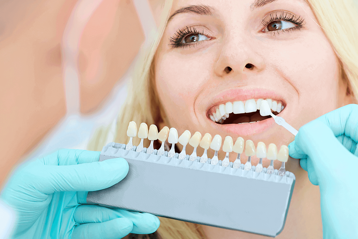 transform your smile with porcelain dental veneers in nw Calgary