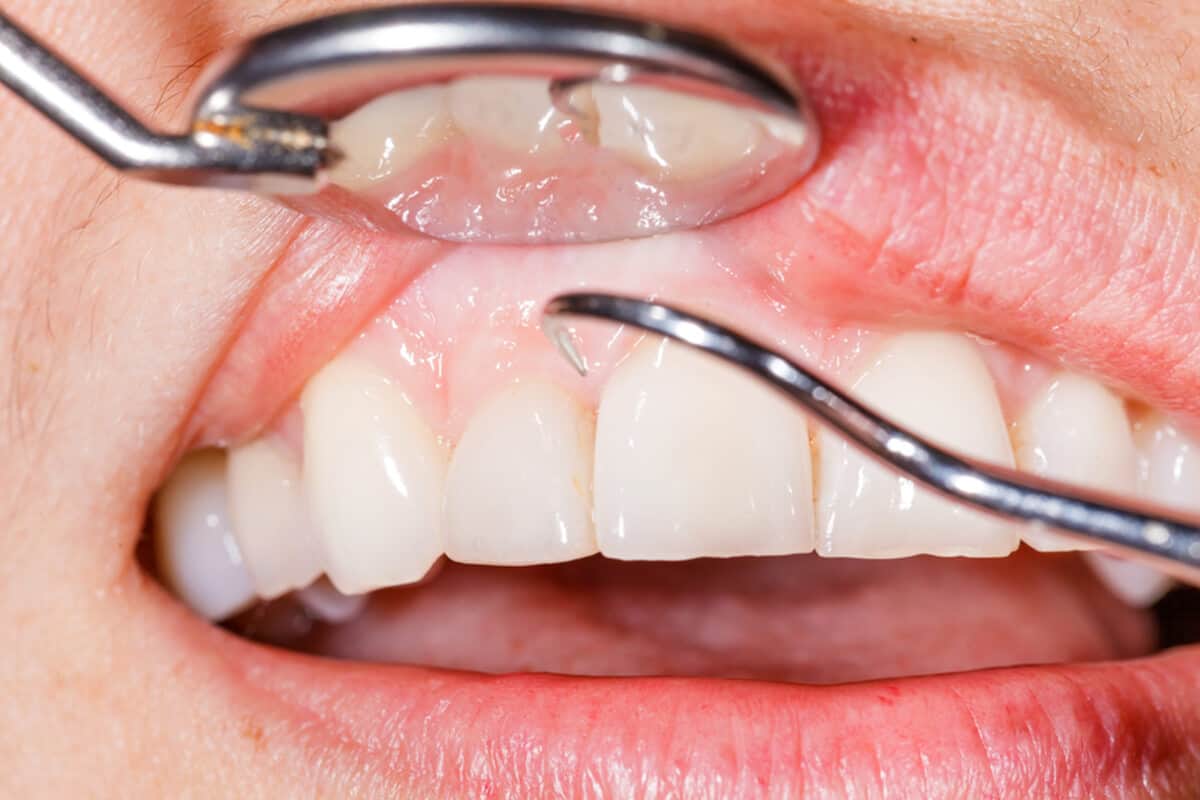 information about periodontics procedures and services
