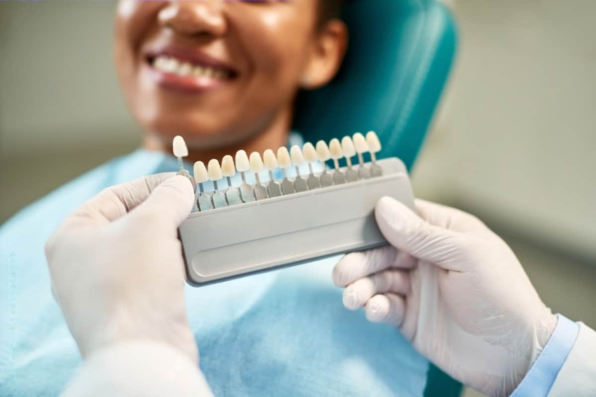 10 ways to maximize the benefits of dental veneers